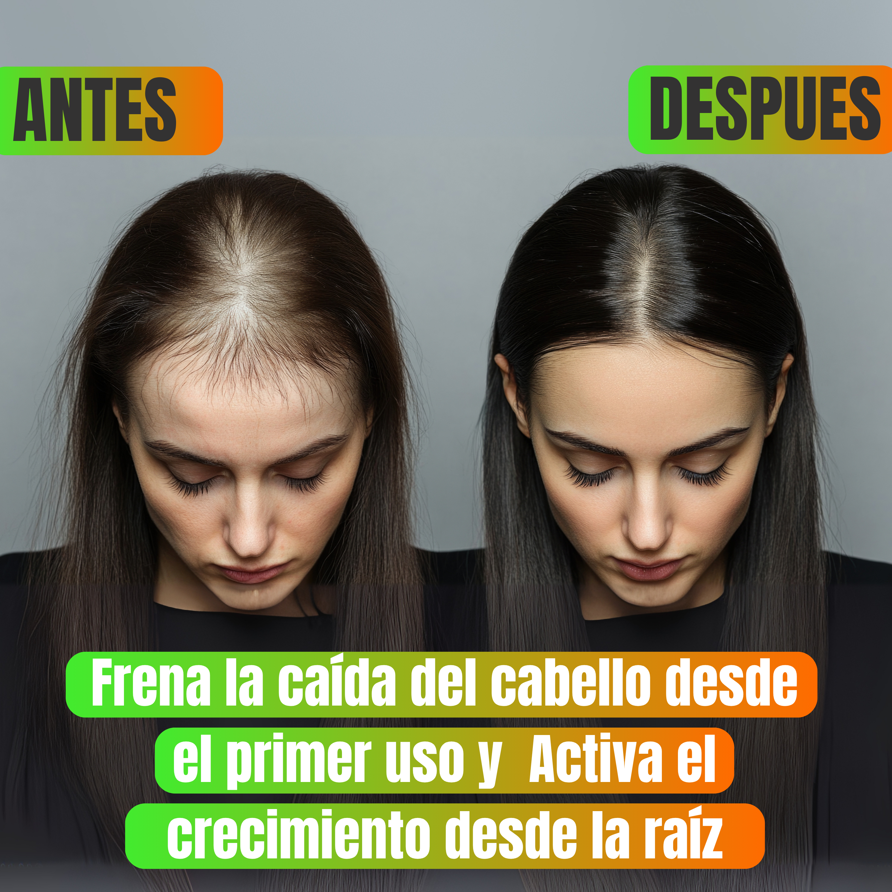 💫 ¡Recuperá tu Cabello por solo Q179!  Shampoo Anti Caída y Crecimiento + Envío GRATIS a todo el país + Pago contra entrega