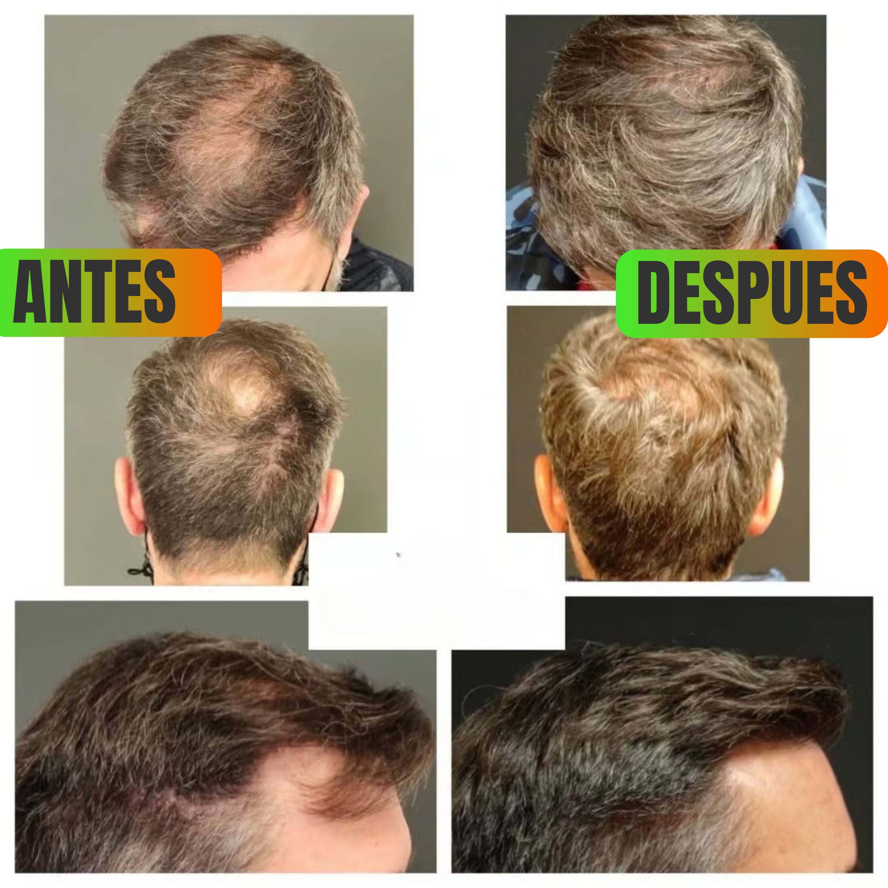 💫 ¡Recuperá tu Cabello por solo Q179!  Shampoo Anti Caída y Crecimiento + Envío GRATIS a todo el país + Pago contra entrega