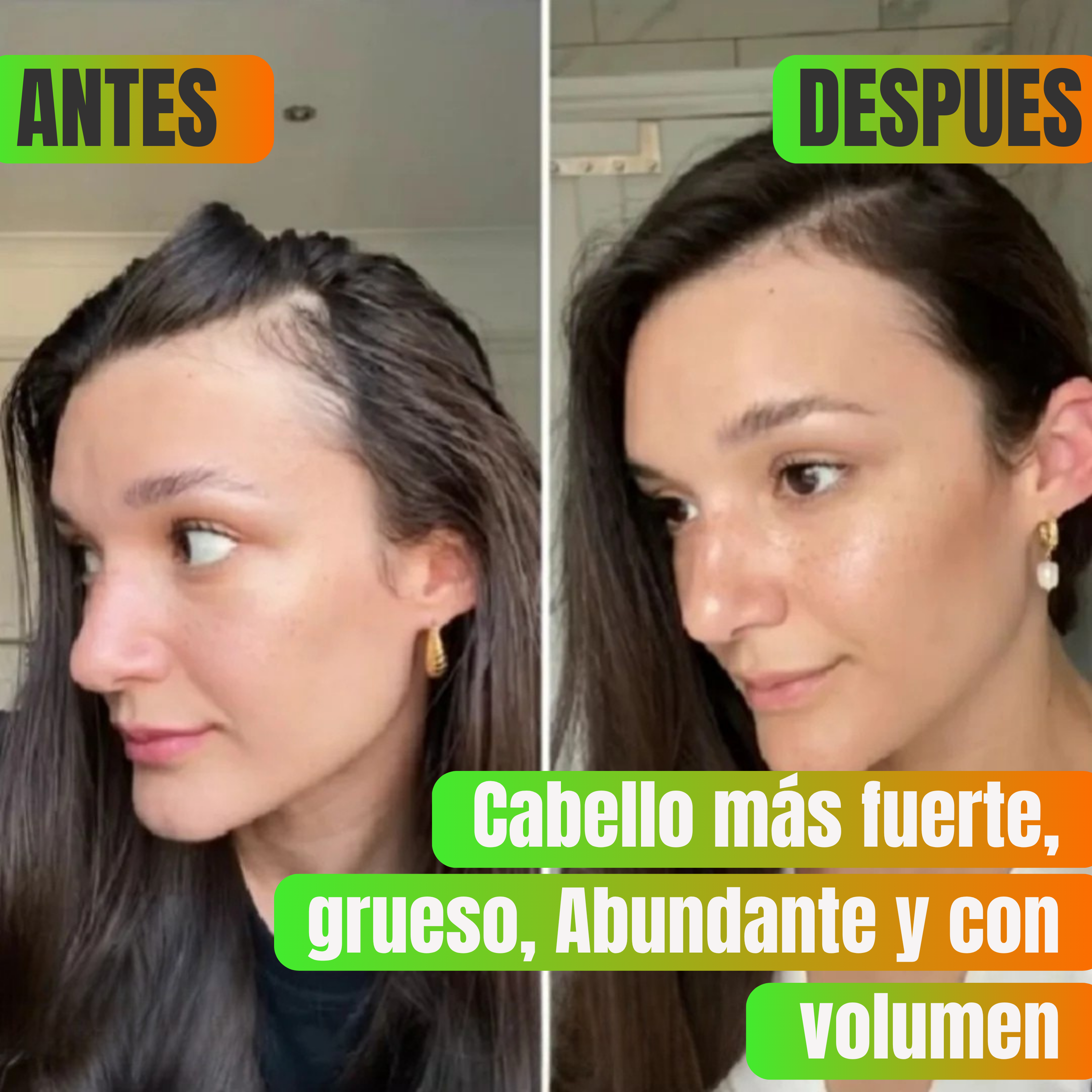 💫 ¡Recuperá tu Cabello por solo Q179!  Shampoo Anti Caída y Crecimiento + Envío GRATIS a todo el país + Pago contra entrega