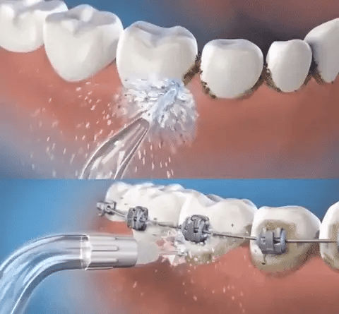 Limpieza Profunda Con Irrigador Bucal Portátil + REGALO